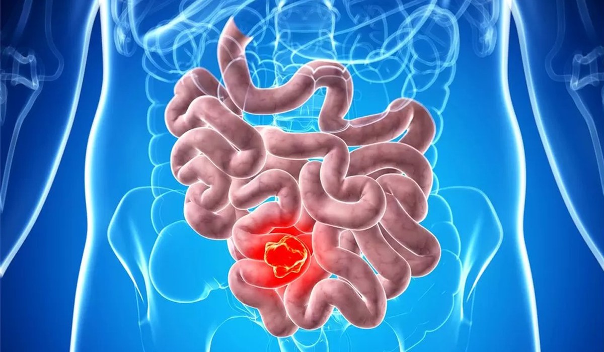 Immune system